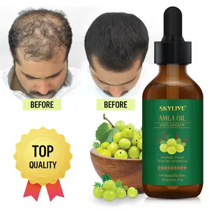 Usine personnalisée 100% Pure soins capillaires pressés à froid cheveux sains et cuir chevelu hydratant Amla huile capillaire avec Offre Spéciale