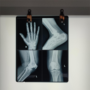 Film radiographique bleu à jet d'encre 10x12 pouces, vente chaude, film médical à base de PET pour le service de <span class=keywords><strong>radiologie</strong></span> hospitalier - Product Image 4