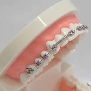 Xiejian Tandheelkundige Orthodontische Handmatige Boogdraad Beschermhuls Buis 5M Elastische Rol Voor Oraal Gebruik Ce Gecertificeerde Klasse Ii Maten - Product Image 1