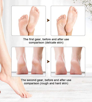 Outil de Pédicure Rechargeable pour les Pieds, Appareil Électrique, Étanche, Pédicure