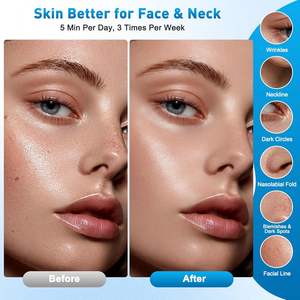 7 En 1 Appareil Masaje Visage Anti Rides Masajista Facial Doble Menton De Beauté Electrique Avec Lifting Masaje Thermique 45 °C - Product Image 5