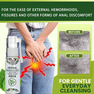 Eelhoe บรรเทาอาการปวดทวารหนักกองริดสีดวงทวารภายนอกรอยแยกทางทวารหนักสเปรย์สมุนไพรธรรมชาติ - Product Image 6