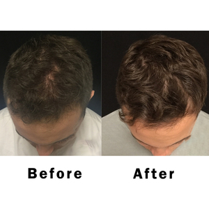 Shampooing et après-<span class=keywords><strong>shampoing</strong></span> 2 en 1 à l'huile de bois de santal et de cardamome pour les <span class=keywords><strong>cheveux</strong></span> des hommes - Product Image 6