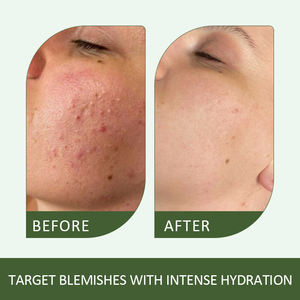 Eau d'essence de Centella multi-phases biologique et végane 130ml, Gel Cica triple action 20g hydratant et éclaircissant - Product Image 3