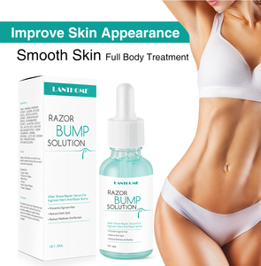 Solution contre les boutons de rasage 30 ml Lotion après-rasage pour hommes Prévenir les poils incarnés Hydratation douce Réparation après-rasage - Product Image 2