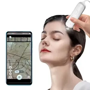 Dermatoscope numérique HD 50X/200X pour l'analyse de la peau et du cuir chevelu, appareil de diagnostic cutané et outil de soin de la peau. - Product Image 4