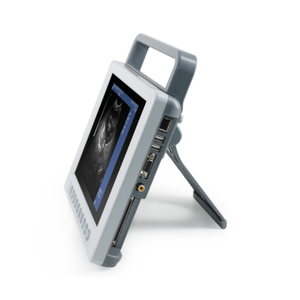 Máquina <span class=keywords><strong>de</strong></span> ultrasonido portátil con escáner <span class=keywords><strong>de</strong></span> ultrasonido 3D veterinario en blanco y negro con modo B Digital completo <span class=keywords><strong>de</strong></span> animales, dispositivo <span class=keywords><strong>de</strong></span> ultrasonido en blanco y negro - Product Image 6