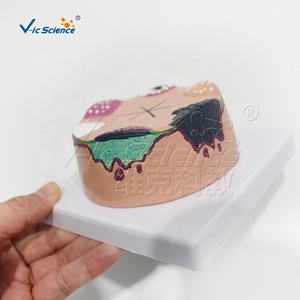 बच्चों के लिए त्वचा कैंसर शारीरिक शिक्षा मॉडल मैनिकिन प्लास्टिक/पीसी - Product Image 4