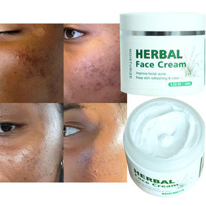 Private Label Herbal Rosto Creme Melhorar Rosto Acne Clareamento Branco Creme Poro Minimizando <span class=keywords><strong>Skincare</strong></span> Produtos De Beleza Agentes - Product Image 1