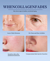 Crème Visage OEM Coréenne Anti-âge Avancée Bio-Activante aux Polynucléotides Purs PN PDRN, Booster de Soin à Base de ADN de Saumon et PDRN