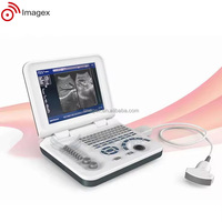 Échographe portable pour ordinateur portable avec transducteur convexe transvaginal et linéaire
