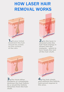 Appareil d'épilation beauté 10,6 pouces, 3 longueurs d'onde, pour toutes les couleurs de peau, appareil d'épilation indolore - Product Image 3