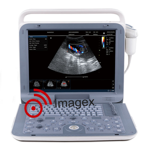 Système d'échographie Doppler couleur portable vétérinaire avec imagerie Doppler <span class=keywords><strong>cardiaque</strong></span> et vasculaire pour animaux et humains - Product Image 1
