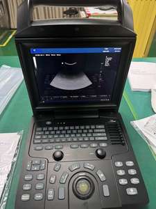 मेकनन शीर्ष गुणवत्ता डिजिटल अल्ट्रासाउंड स्कैनर अल्ट्रासाउंड अल्ट्रासाउंड मशीन - Product Image 6