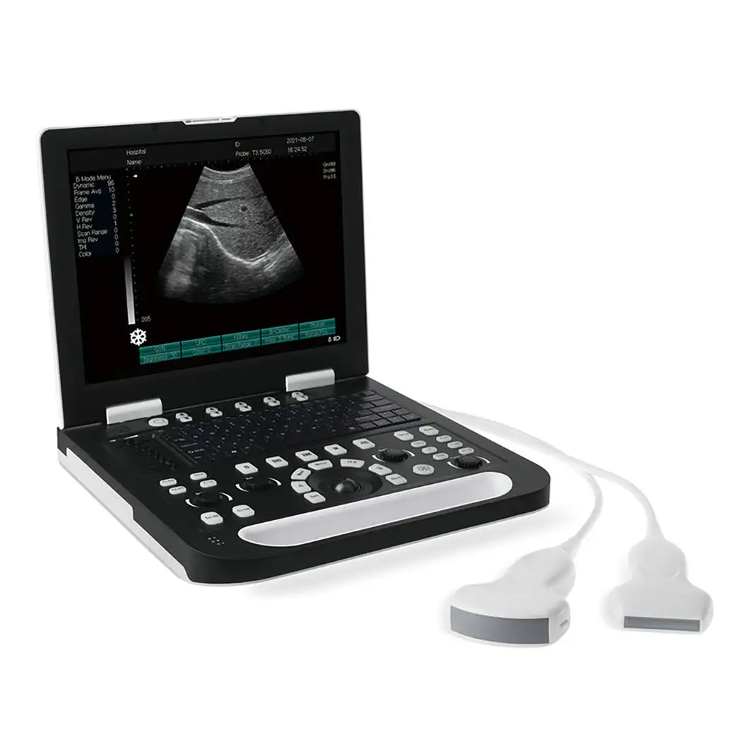 Système de Diagnostic à ultrasons Doppler couleur entièrement numérique de 15 pouces, scanner à ultrasons Portable pour vétérinaire et humain