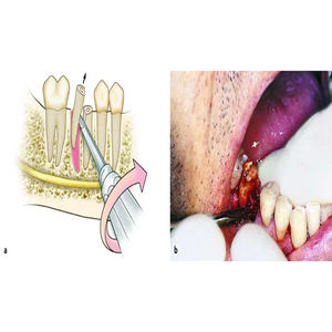 M.A SIDDIQUE INTERNATIONAL 2025 Kit d'instruments de chirurgie dentaire en acier manuel pince élévatrice ascenseur d'extraction entièrement stérilisé - Product Image 5
