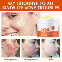 Ventes Flash Crème Visage Bio 30g Contre l'Acné, Rougeurs et Gonflements, Réparatrice