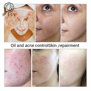 OEM/ODM Savon blanchissant <span class=keywords><strong>Eclat</strong></span> Gold Savon aux acides aminés Savon en barre 24 carats d'or Savon anti-âge au collagène 24 carats - Product Image 6