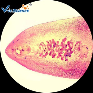 Juego de Portaobjetos Preparados de Parasitología para Ciencias Médicas, Portaobjetos de Parasitos para Microscopio - Product Image 5