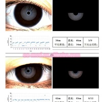 EOMED DEA50 High Precision Metal Dry Eye Analyzer Professional Fluorescent Stain Analysis Automatic Measurement Clinic Use