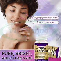 VitaSpring OEM Complexe de Vitamines B (B1, B6, B12) en Capsules – Soutien Cheveux, Peau et Énergie – Complément Multivitaminé – Gélules Molles de Vitamines B