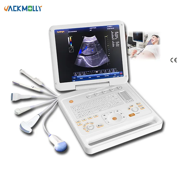 אבחון לב מקצועי cw 4d eocardiography צבע מכונת אולטרסאונד