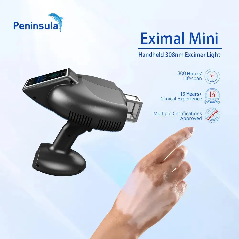 Peninsula Vitiligo Psoriasis Treatment 308nm Excimer Laser System For Home Use