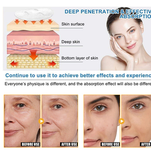 Nhãn hiệu riêng Bio-Collagen sâu Hydrogel Collagen qua đêm Mặt nạ dưỡng ẩm lỗ chân lông giảm thiểu độ đàn hồi cải thiện mặt nạ trên khuôn mặt - Product Image 6