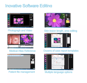 Colposcope numérique vidéo HD 1080P de haute définition Kernel Colposcopio <span class=keywords><strong>KN</strong></span> 2200A avec <span class=keywords><strong>filtre</strong></span> vert spécial à 4 niveaux - Product Image 2