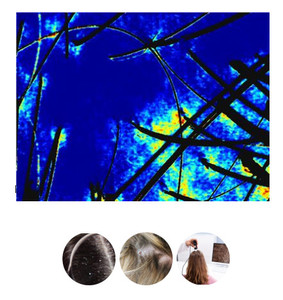 New Technology <strong>HD</strong> Skin <strong>Anal</strong>;yzer Hair Analysis Machine Scalp Camera Hair Analyzer for Hair Salon and Beauty Clinic - Product Image 3