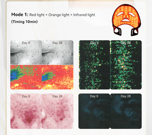 Rotlichttherapie Photonen-Therapie Handgehaltene Silikon-LED-Gesichtsmaske mit Individuellem Logo für Lippen- und Gesichtsschönheit - Product Image 3