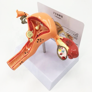 Modelo de útero patológico para mujer, modelo médico femenino para demostración - Product Image 3