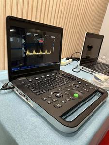 C10 rumah sakit portabel warna doppler ecograph Harga terbaik 3D portabel warna Doppler <span class=keywords><strong>ultrasound</strong></span> - Product Image 3