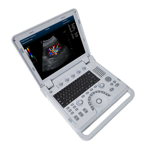 Échographe portable CMS1700B pour la gynécologie, diagnostic vasculaire périphérique, instrument d'échographie Doppler couleur <span class=keywords><strong>3D</strong></span>/4D - Product Image 2