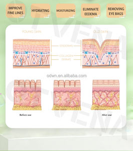 OTVENA <span class=keywords><strong>Mejor</strong></span> Etiqueta Privada <span class=keywords><strong>Crema</strong></span> de estiramiento de ojos instantánea Hidratante profundo Eliminación de Círculos oscuros - Product Image 5