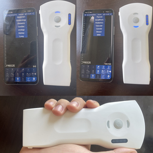 Suresult <strong>Handheld</strong> Ultrasound <strong>Doppler</strong> 18 Frames High Speed Clear Image Linear/convex Head Portable Wireless Ultrasound - Product Image 4