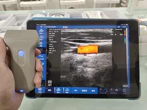 Échographe Doppler Couleur Portable Sans Fil à Sonde Convexe Personnalisable pour la Grossesse - Product Image 5