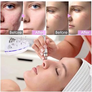 Máquina de Diamante con Pulverizador para Eliminar Puntos Negros, Oxígeno Jet Peel Facial, <span class=keywords><strong>Limpieza</strong></span> Profunda, Hidratación de la Piel Za It - Product Image 3