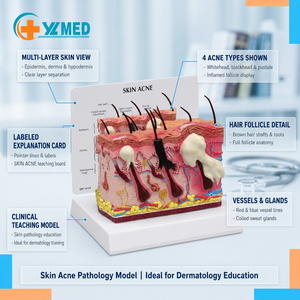 Modello Anatomico della Pelle Umana con Acne per l'Insegnamento della Biologia, con Occhio in Metallo, per Scuole e Ospedali, Certificato CE/ISO - Product Image 1