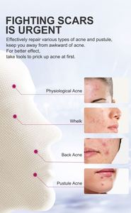 Crema Trattamento Acne al Mango con Spedizione Gratuita, Riduce le Macchie dell'Acne, Crema Levigante - Product Image 5