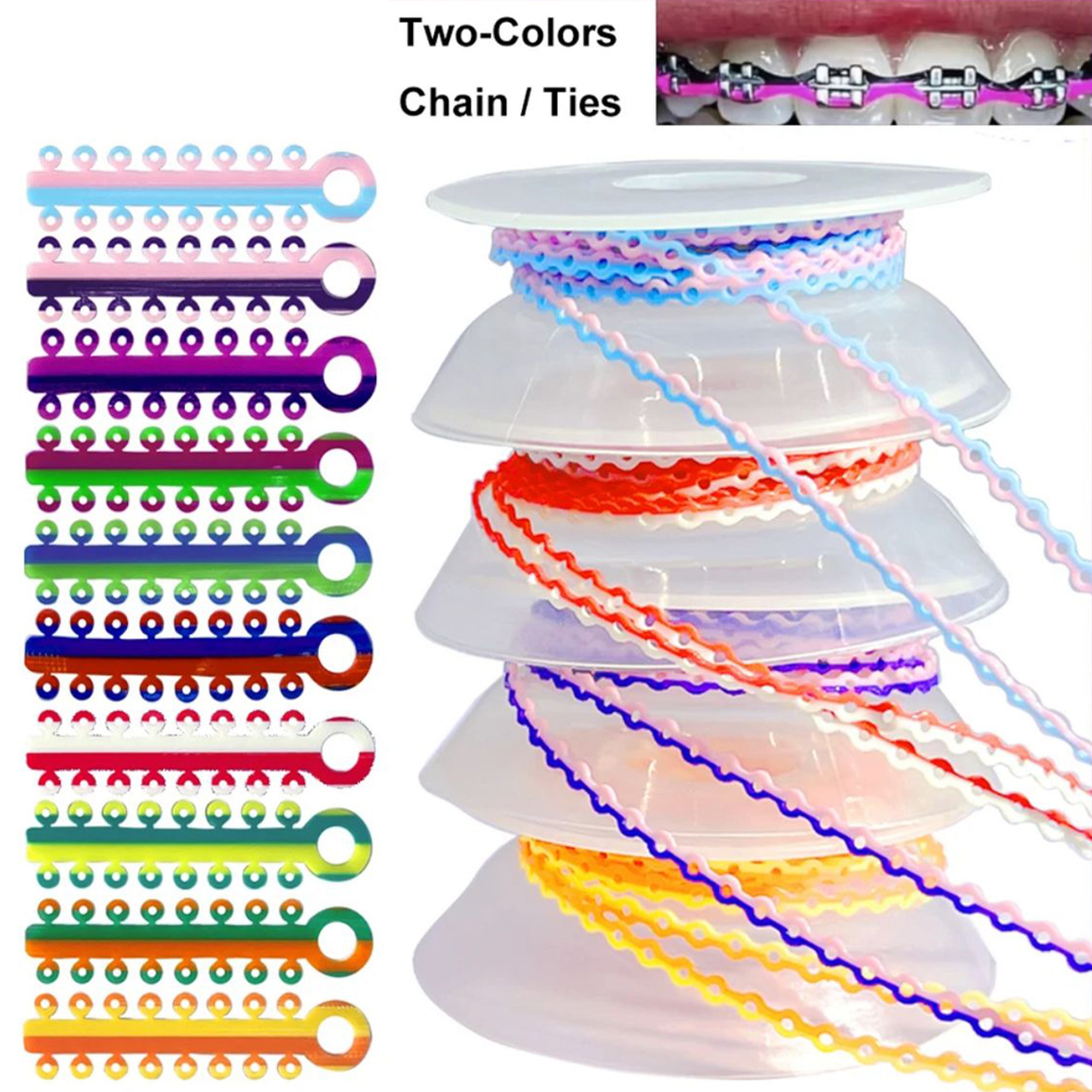 ligature wire orthodontics