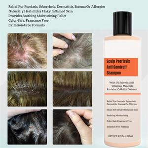 Shampooing et revitalisant pour le cuir chevelu, <span class=keywords><strong>psoriasis</strong></span>, pellicules, dermatite séborrhéique, peau irritée, pelliculaire et enflammée, <span class=keywords><strong>apaisant</strong></span>, hydratant, soulagement - Product Image 2