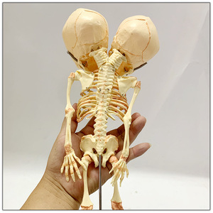 Medical Teaching Model Halloween Decoration <strong>Baby</strong> <strong>Skeleton</strong> Model 2-Headed Fetal <strong>Skeleton</strong> Deformity Newborn Infant <strong>Skeleton</strong> Model - Product Image 3