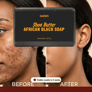 <span class=keywords><strong>Savon</strong></span> noir africain Luxfume, beurre de karité brut, végan, contrô<span class=keywords><strong>le</strong></span> du sébum, nettoyage en profondeur, hydratant, barre <span class=keywords><strong>pour</strong></span> une <span class=keywords><strong>peau</strong></span> éclatante, fait à la main, sans produits agressifs - Product Image 1