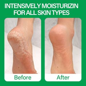 Crème de Soin Réparatrice pour les Pieds Marque Blanche Adoucit et Revitalise les Talons et Pieds Secs et Fissurés Crème pour les Pieds à l'Huile d'Arbre à Thé - Product Image 6