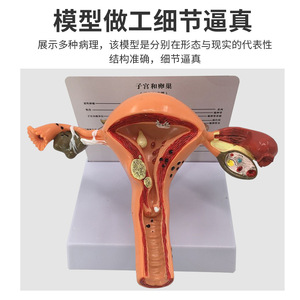 Modelo de órganos reproductores femeninos, modelo de útero privado, material didáctico, modelo ginecológico de ovarios - Product Image 3