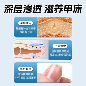 Solution antifongique pour les pieds, crème pour l'élimination des ongles périunguéaux, solution de soin pour l'onychomycose, médicament contre les mycoses des ongles, soin des pieds - Product Image 3
