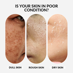 Vente en gros Marque privée Riz hydratant doux Nettoyant pour le visage Extrait de riz naturel Nettoyage en profondeur Nettoyant pour le visage - Product Image 5