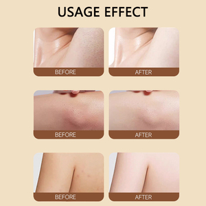 สบู่ล้างหน้าทำมือทำจากกรดขมิ้นและโคจิกธรรมชาติทำจาก100% - Product Image 6