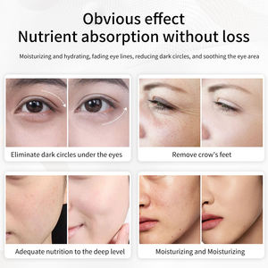 Appareil anti-âge SMAS pour les yeux, pour éliminer les poches et les gonflements, lifting et raffermissement du visage, beauté - Product Image 6